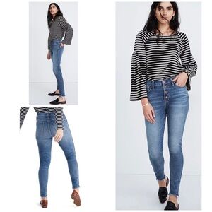 Madewell 10" High-Rise Button-Front Skinny Jeans​​​​​